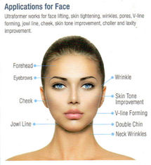 دستگاه زیبایی پوست HIFU پوست چروک پوست چهره غیر قابل انعطاف