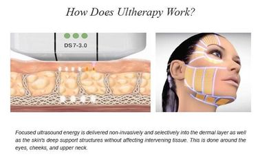 دستگاه زیبایی HIFU اولتراسوند با شدت بالا برای درمان صورت در سالن زیبایی