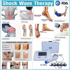 فوق العاده کمردرد درد تسکین دهنده ESWT دستگاه Shockwave Therapy ، دستگاه فیزیوتراپی Shockwave