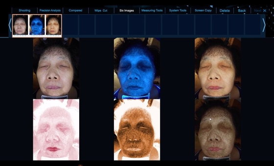 6 طیف تجهیزات بیشتری برای تجزیه و تحلیل پوست صورت را ببینید