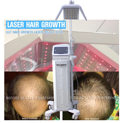 دستگاه رشد لیزر مو قابل تنظیم با دیودهای لیزر واقعی با طول موج 650nm / 670nm
