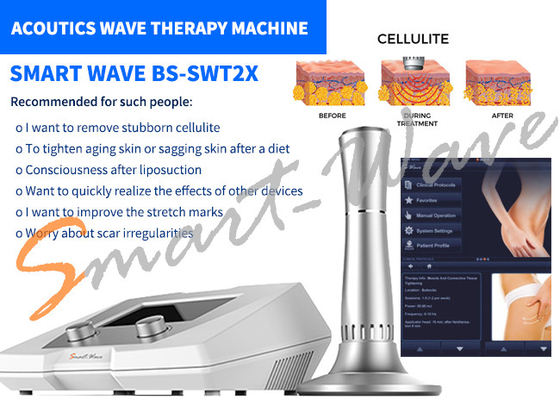 سالن زیبایی BS-SWT2X موجی صوتی تراش دستگاه حذف سلولیت 1 سال ضمانت