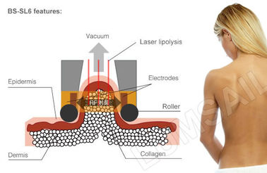 Cryolipolysis دستگاه لاغری فریزر چربی بدن سیستم لاغر بدن برای حل چربی