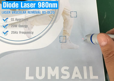 دستگاه لیزر دیود 980 نانومتری قابل حمل برای حذف برچسب های پوست