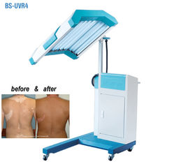 درمان فتوتراپی UVB Light Therapy Machine، UVB باریک نورپردازی درمان
