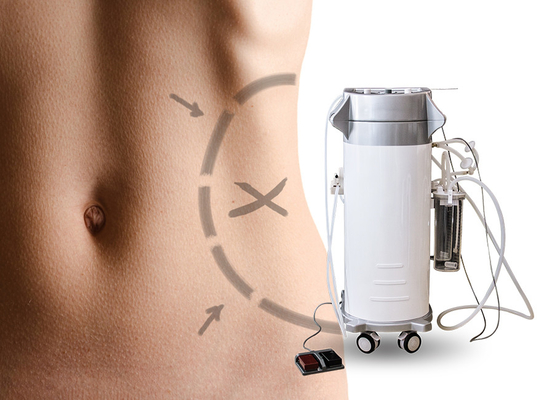دستگاه لیپوساکشن جراحی زیبایی برای دستگاه لاغری مکش جراحی زیبایی شکم / بازو