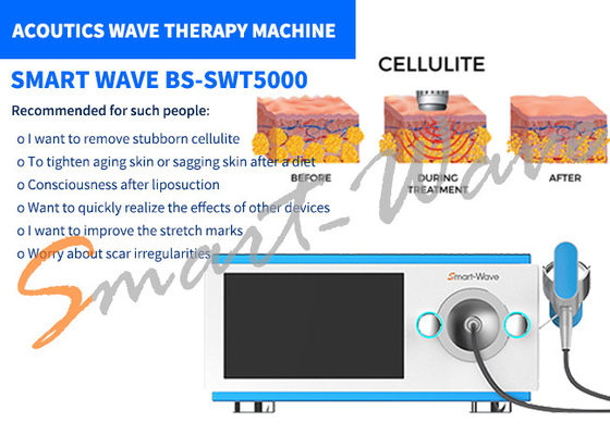 6 دستگاه تراشنده موج صوتی دستگاه درمانی برای برداشتن علائم کششی / تغییر شکل بدن