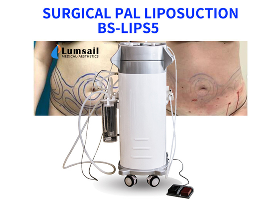 تجهیزات لیپوساکشن به کمک نیروی BS-LIPS5 300W برای سینه گردن و چانه